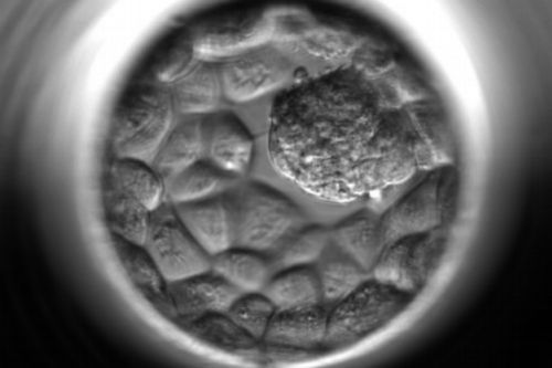 blasto-embriones